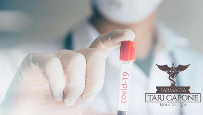 Test diagnostici COVID-19